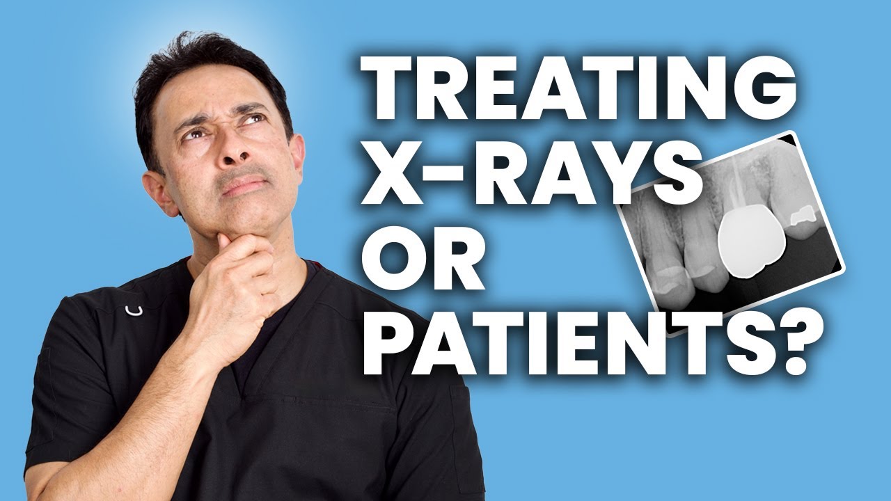 What Really Matters in Endodontics