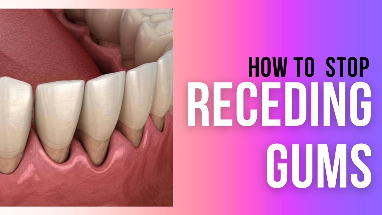 What Causes Gum Recession and How To Stop It'- [Holistic Dentist Brisbane]