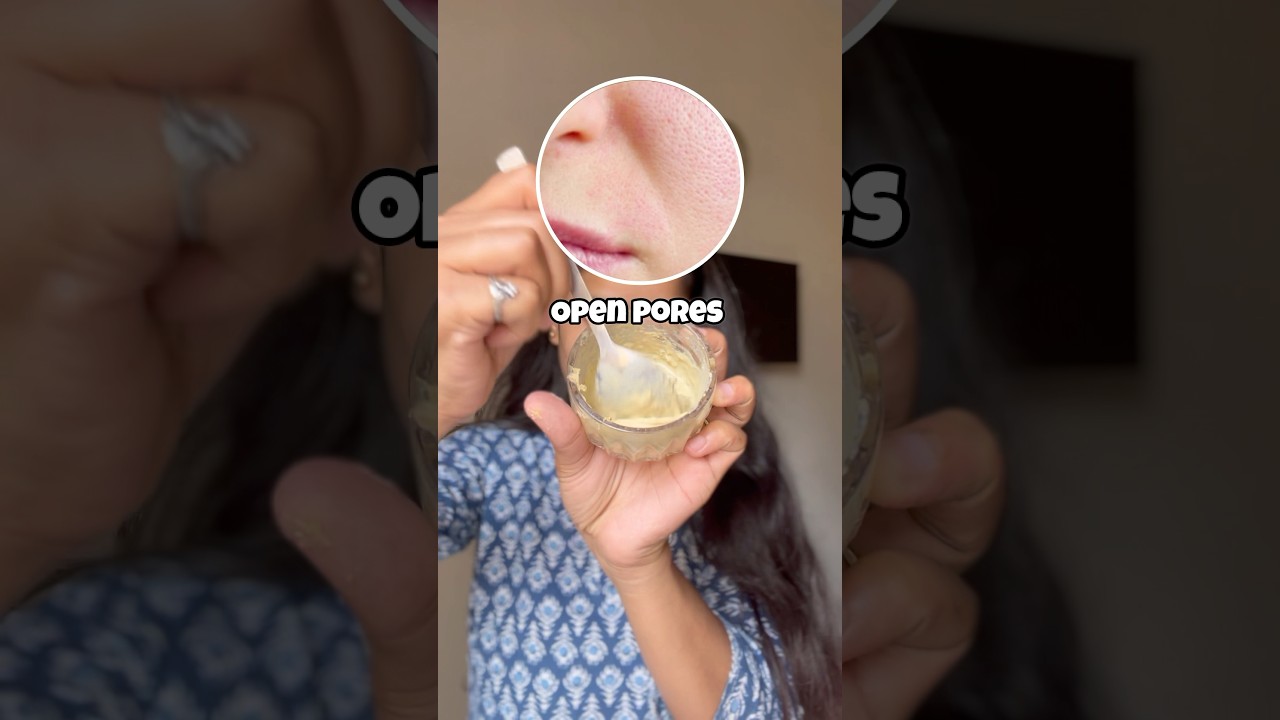 Still struggling with open pores , oily skin ???