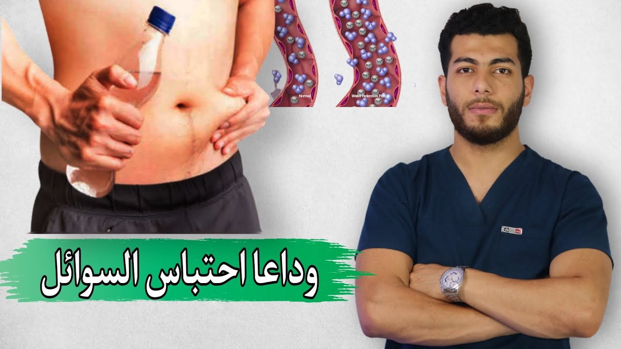 اسرع طريقه لعلاج احتباس السوائل تماما وبدون ادويه |كيفيه التخلص من الماء الزائد في الجسم