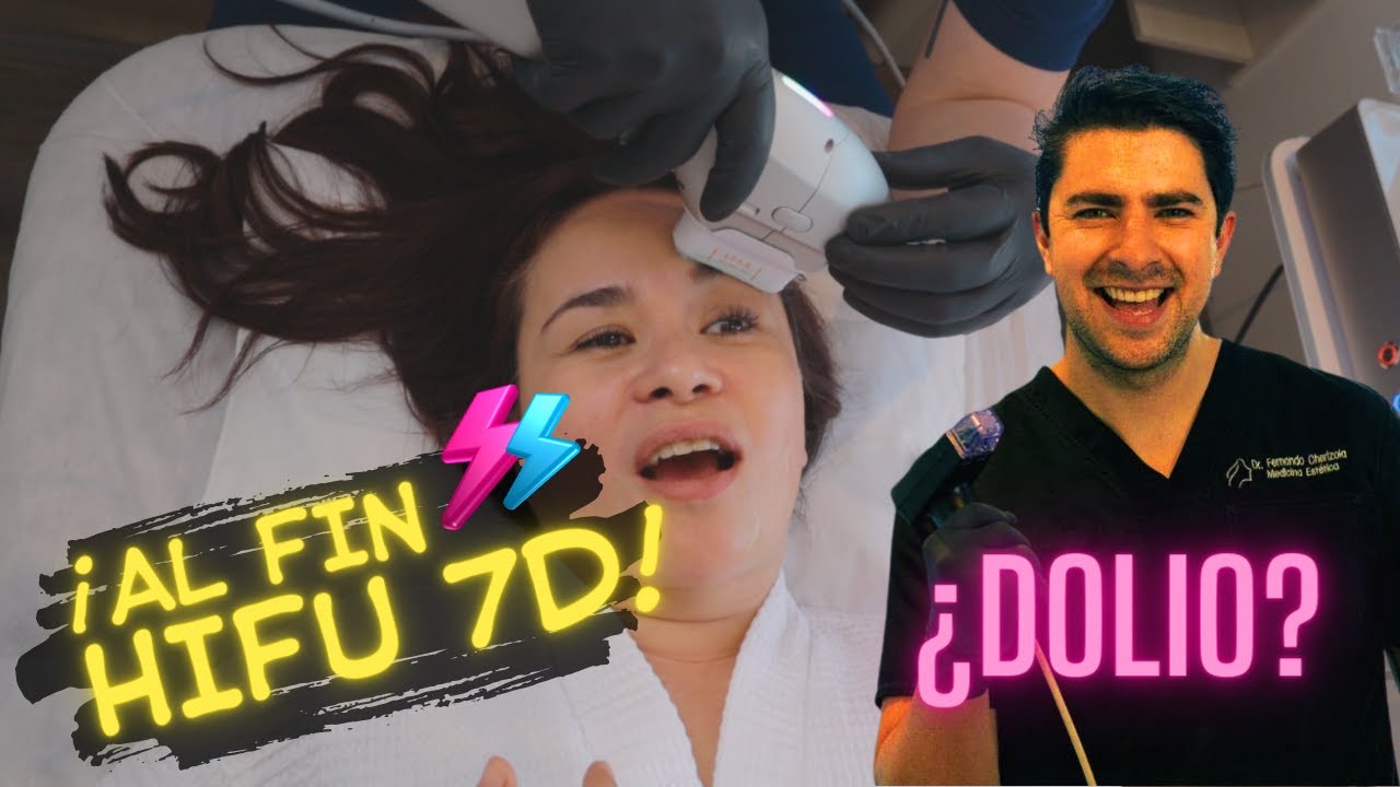 HIFU facial 7D antes y después, duele? vive conmigo paso a paso @dr.fernandocherizola3280