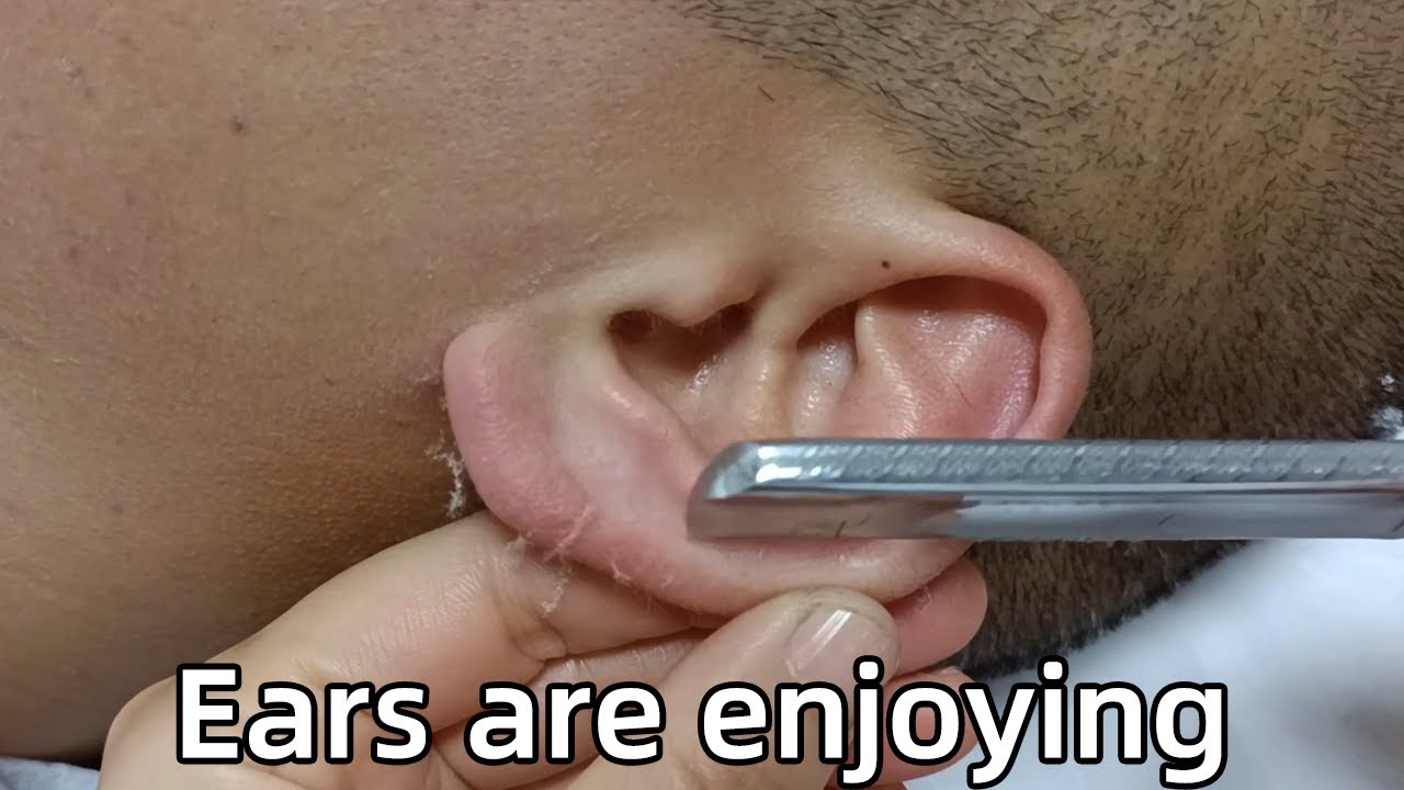 💈ASMR Rare Razor Shave|Shaving ears is a massage for the brave！Don't worry, enjoy it！relieve stress