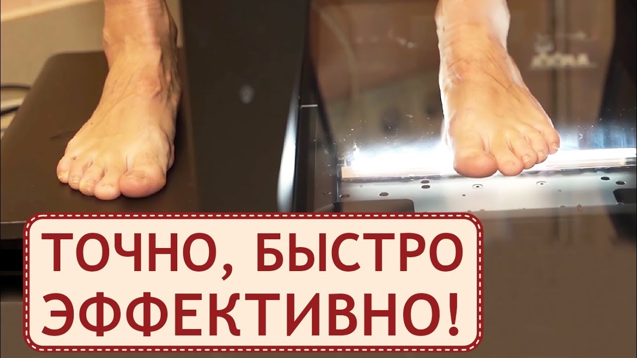 💻 3D технологии в производстве идеальной ортопедической обуви. Сканирование стопы. 12+