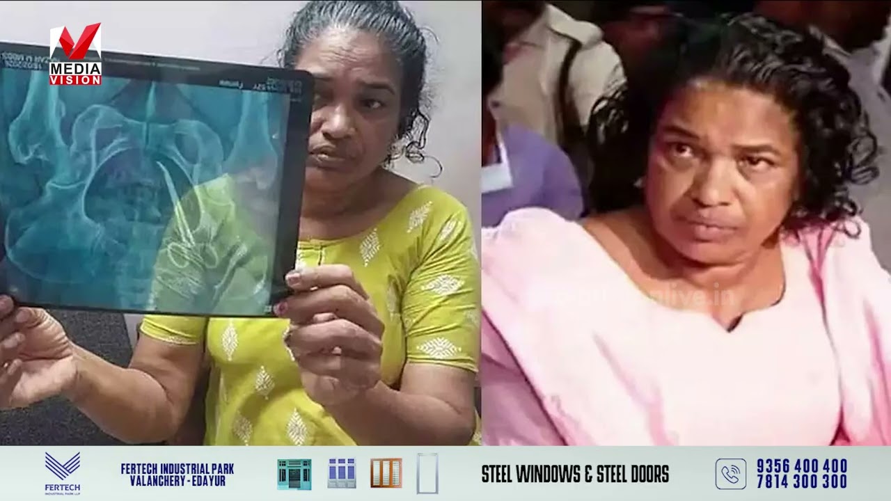 ഉഷയുടെ ശസ്ത്രക്രിയ കഴിഞ്ഞു; കത്രിക പുറത്തെടുത്തു, തൊണ്ടിമുതല്‍ അന്വേഷണ ഉദ്യോഗസ്ഥന് കൈമാറി