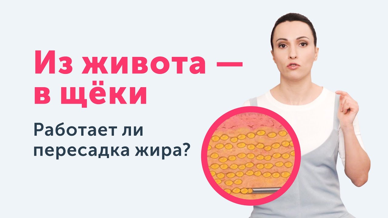 Липофилинг. Зачем пересаживать жир в лицо?