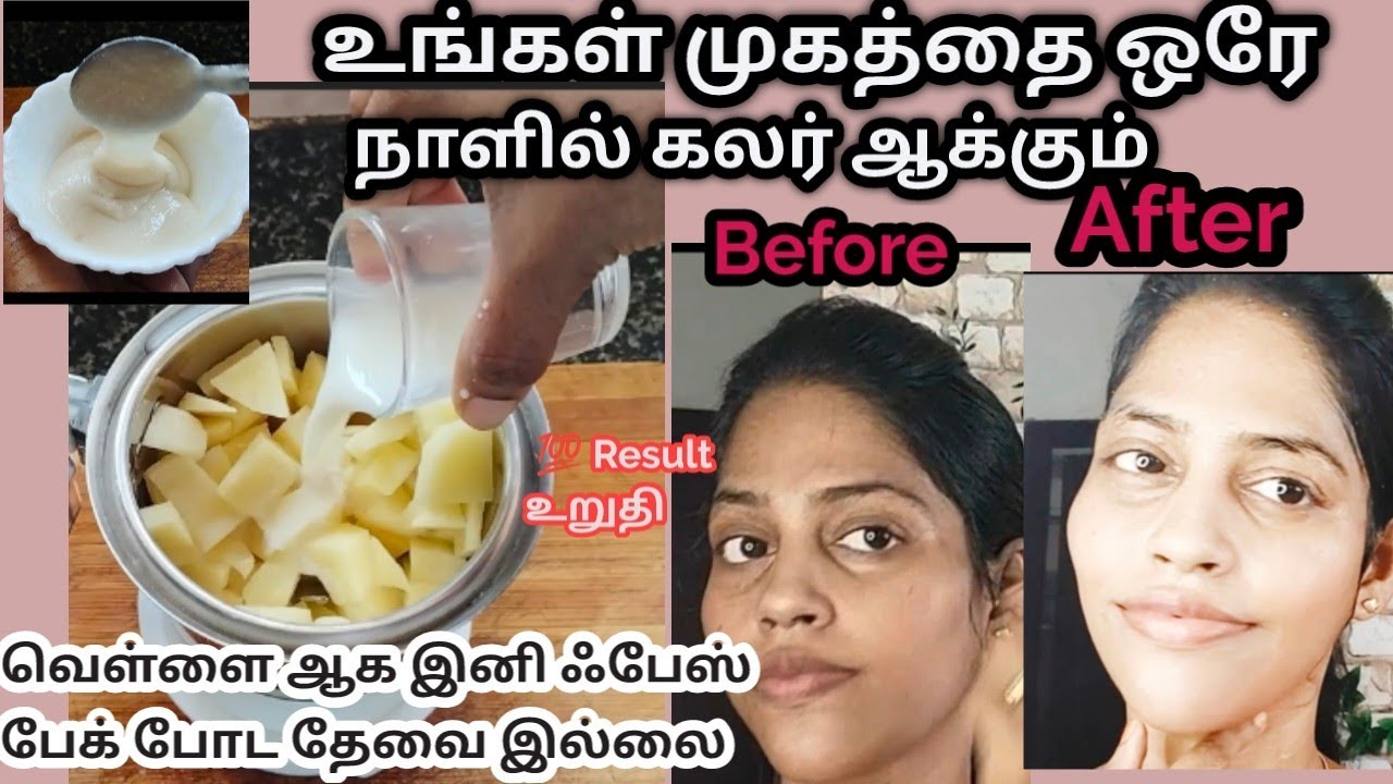 My top best skin whitening cream