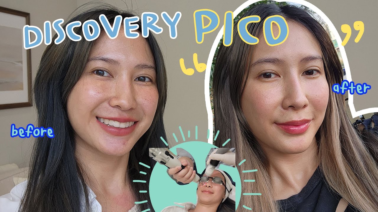 ครั้งแรกกับ Discovery PICO ผลลัพธ์เกินคาด!