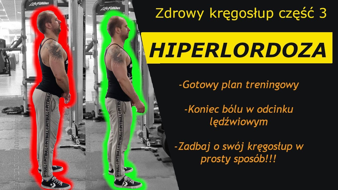 Jak wyleczyć HIPERLORDOZĘ w odcinku lędźwiowym! Jakie ćwiczenia wykonywać, gotowy plan treningowy!!