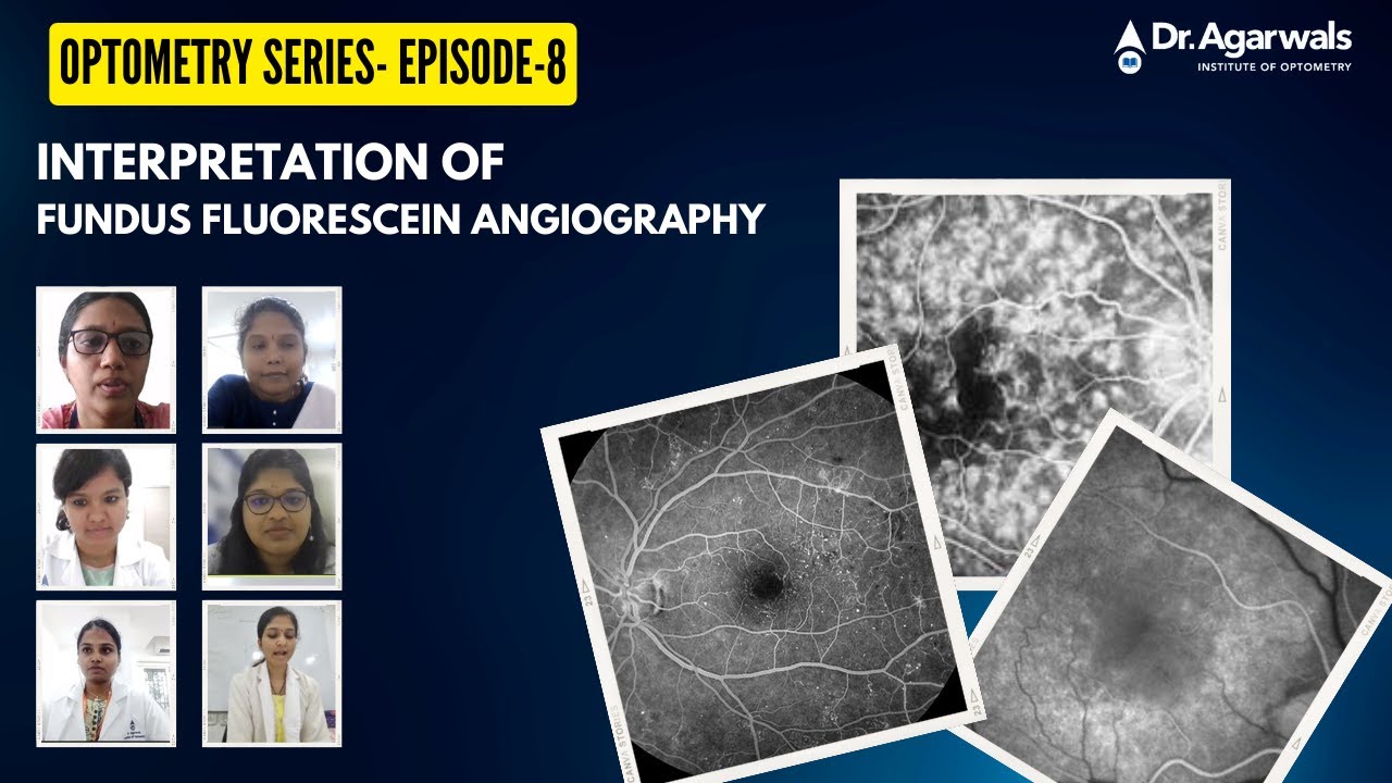 Optometry Series Episode-8 Interpretation of Fundus Fluroscein Angiography