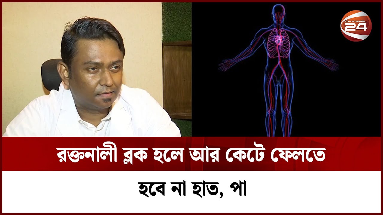 রক্তনালী ব্লকের সুচিকিৎসা মিলছে দেশেই | Vascular surgery | Channel 24