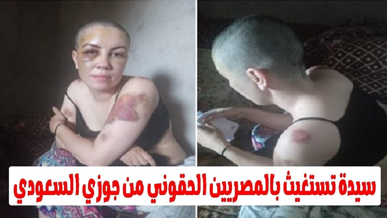 جوزي حط ماسورة حديد فى اعضـ / ـائي التنـ / ـاسلية..استغاثة سيدة مصرية مما حدث لها فى السعودية