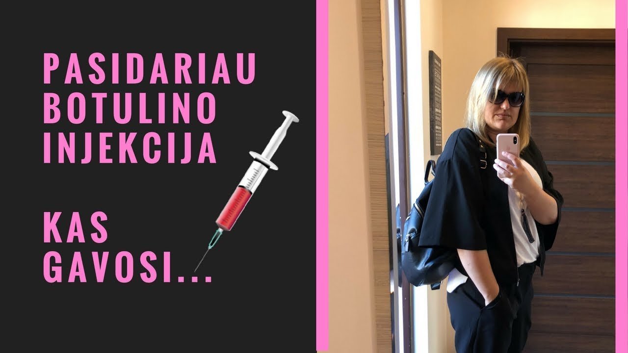 Botulino injekcija. Mano patirtis. Ar verta? Prieš ir po rezultatas. Grozis