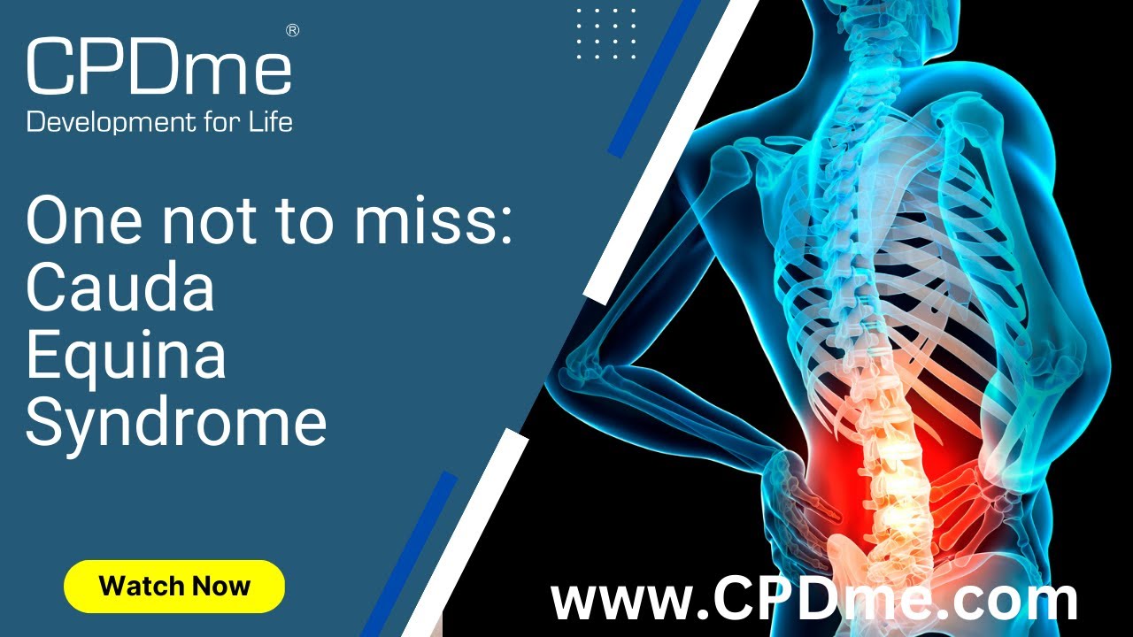 CPD Webinar - One not to miss: Cauda Equina Syndrome by David Metcalfe