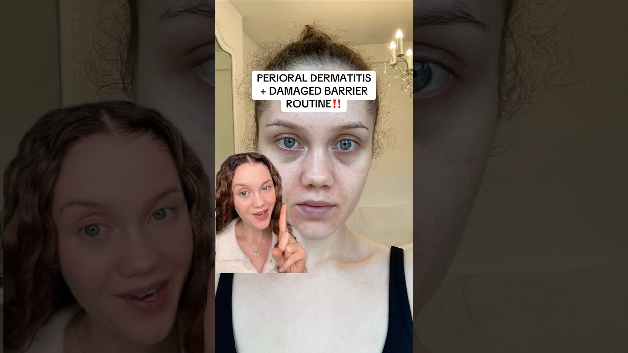 ПЕРИОРАЛЬНЫЙ ДЕРМАТИТ ПОВРЕЖДЕННЫЙ КОЖНЫЙ БАРЬЕР‼️#damagedskinbarrier #skinbarrierrepair #periora...
