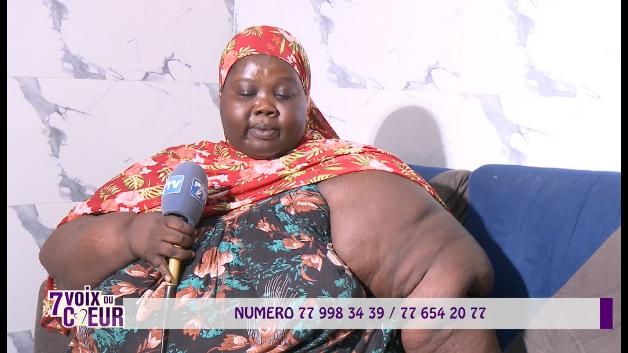 🔴#7voixducoeur: Souffrante d'obésité, Ndèye Fatou NDIAYE raconte son calvaire et sollicite de l'aide