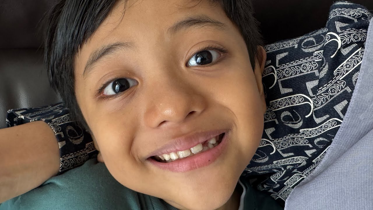 Cabut Gigi. Dokter Kaget Ditanya Mau Nonton Apa, Adip Minta Nonton Mural.