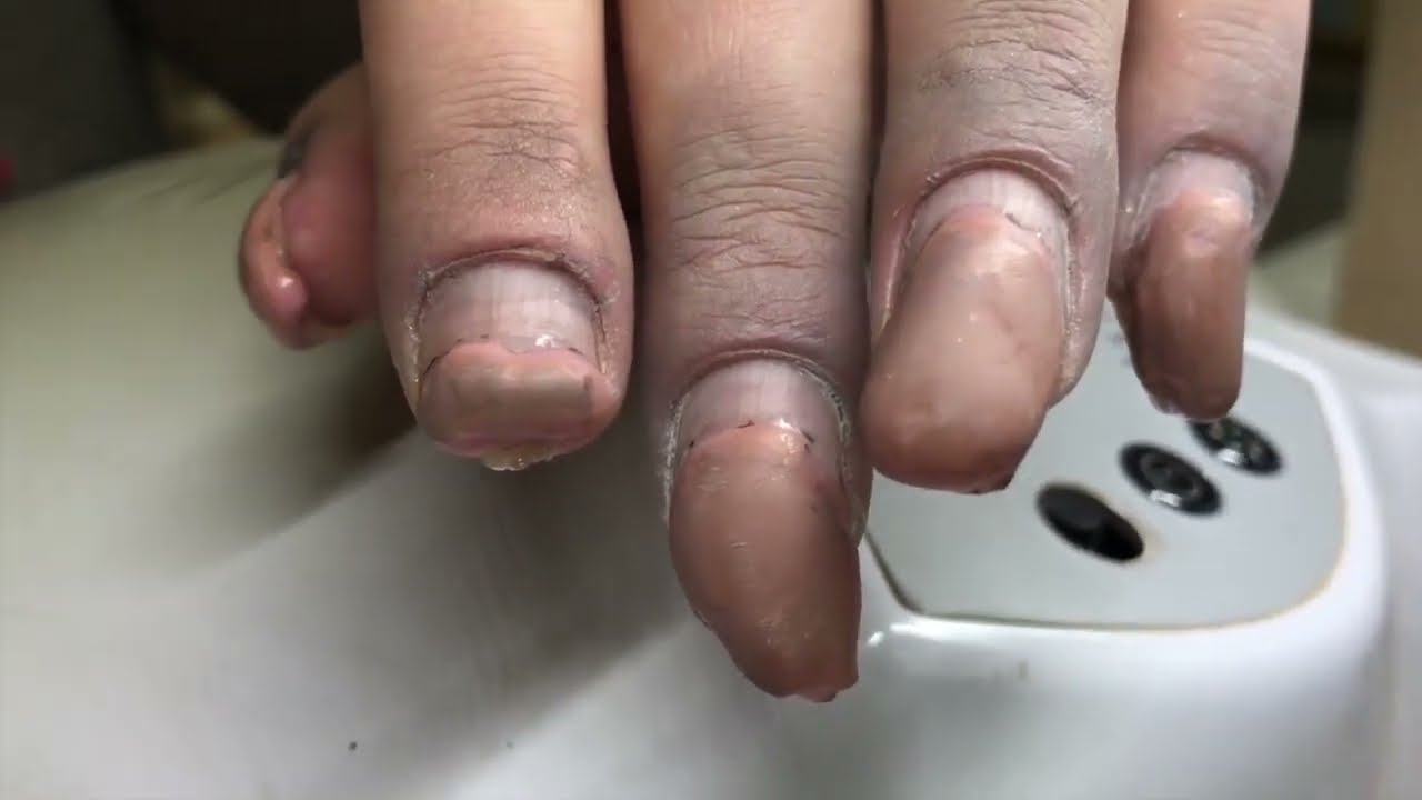 #😱HOW COULD SHE DESTROY HER NAILS LIKE THAT!!! LEFT LEG OR NAILS, or nails made with the left leg.