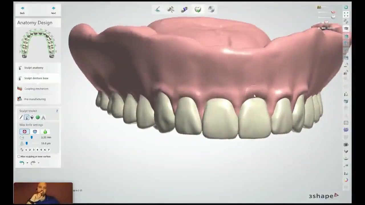 Stratasys Academy | Conception de prothèse copiée dans 3Shape pour TrueDent