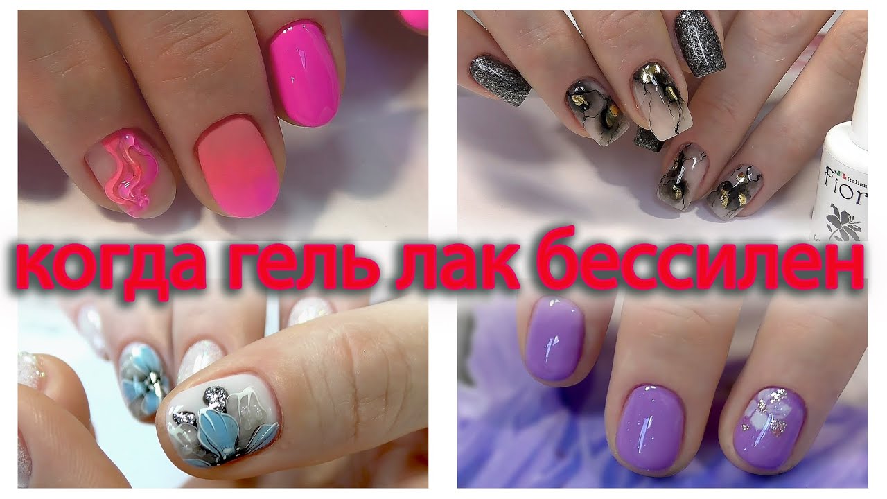 ХРОНИКА! Ушибленный ноготь, последствия. ДИЗАЙН НОГТЕЙ 2020