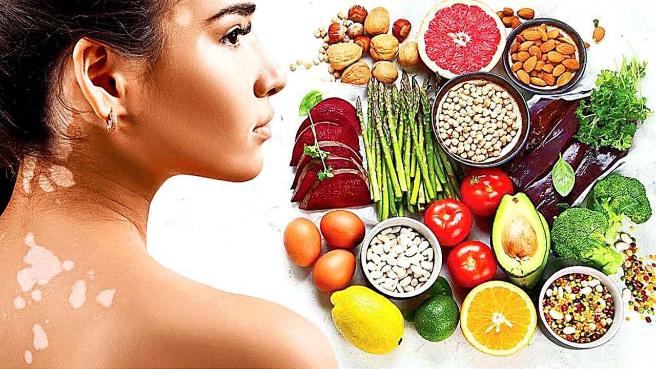 Best Foods for AUTOIMMUNE DISEASE