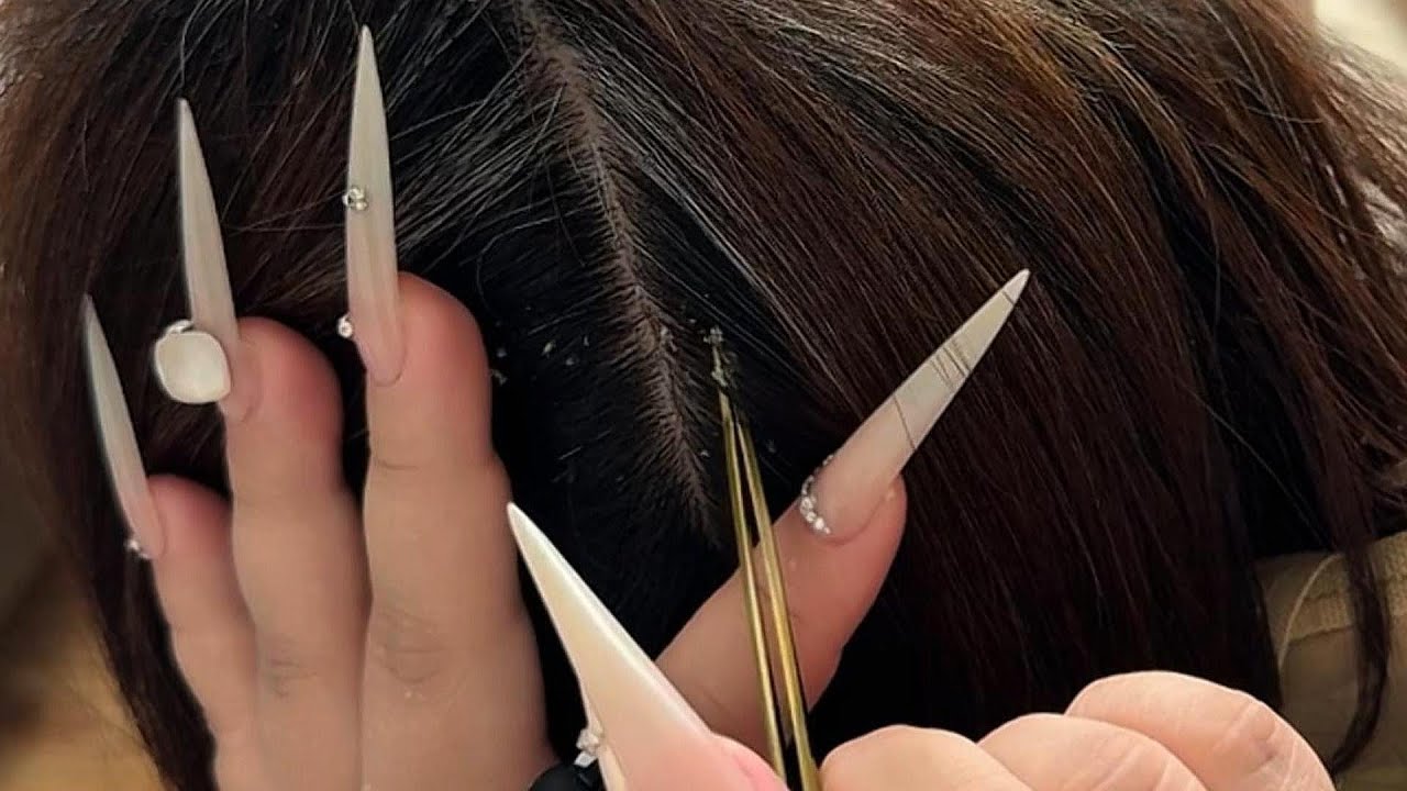 Ultimate Flake Hunt: Long Nails & Tweezers ASMR Scalp Sleep Aid