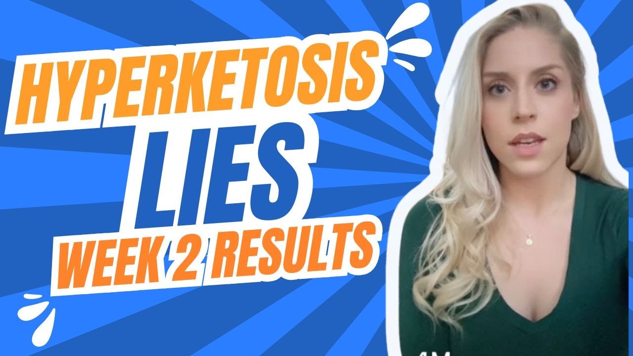 Hyperketosis Doesn’t Work — What They Don’t Tell You