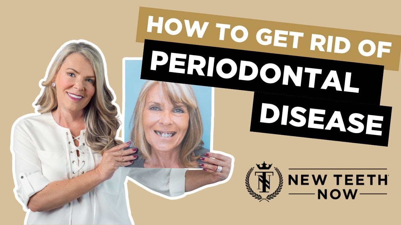 How to get rid of periodontal disease?