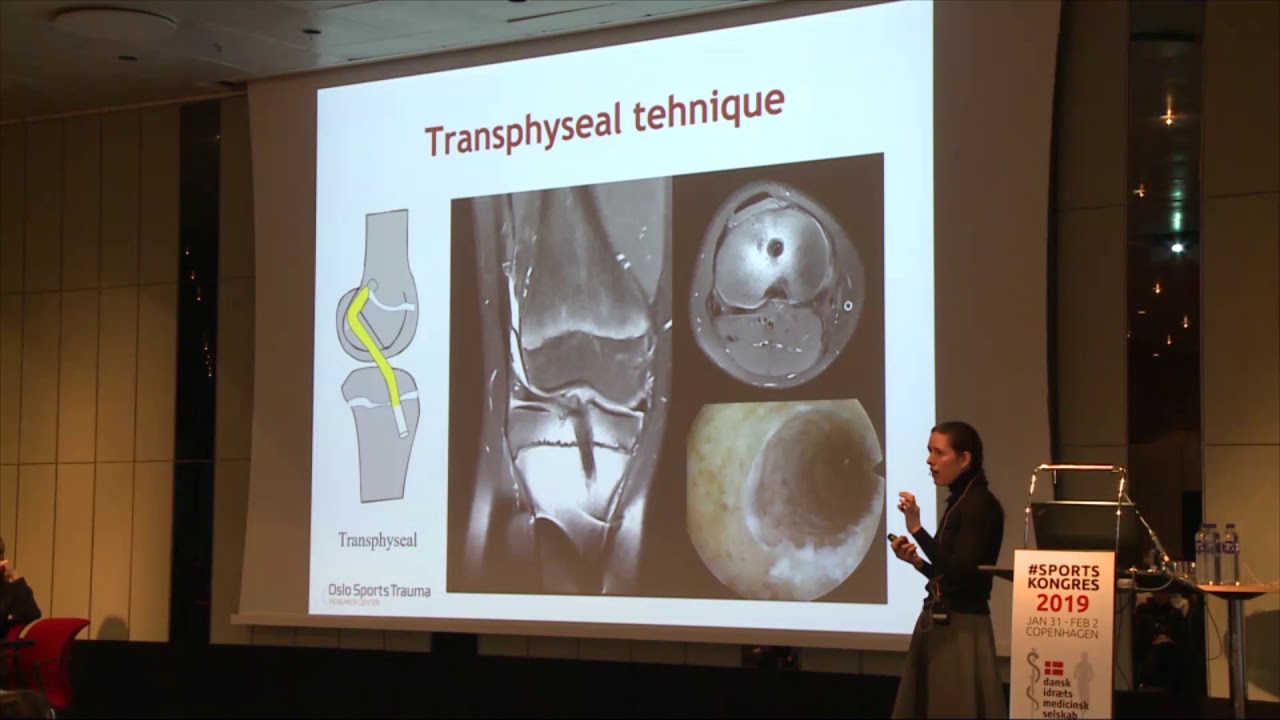 ACL injuries in children - #SportsKongres 2019