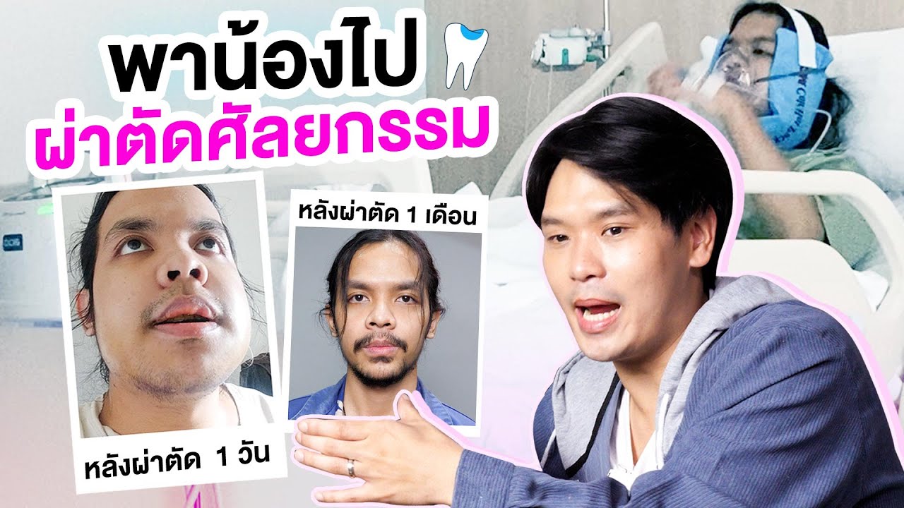 พาน้องไปผ่าตัดศัลยกรรม | เทพลีลา