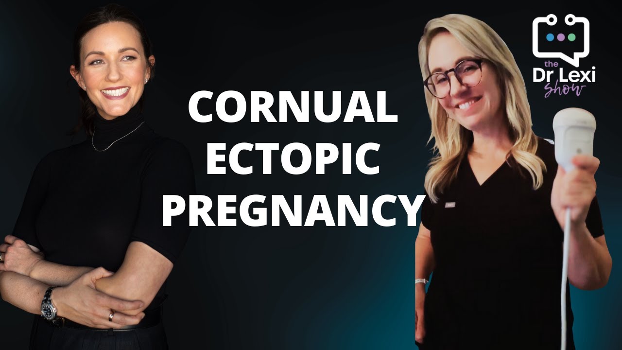 Rare Cornual Ectopic Pregnancy Results in Live Birth | High-Risk Doctor and Sonographer Discuss