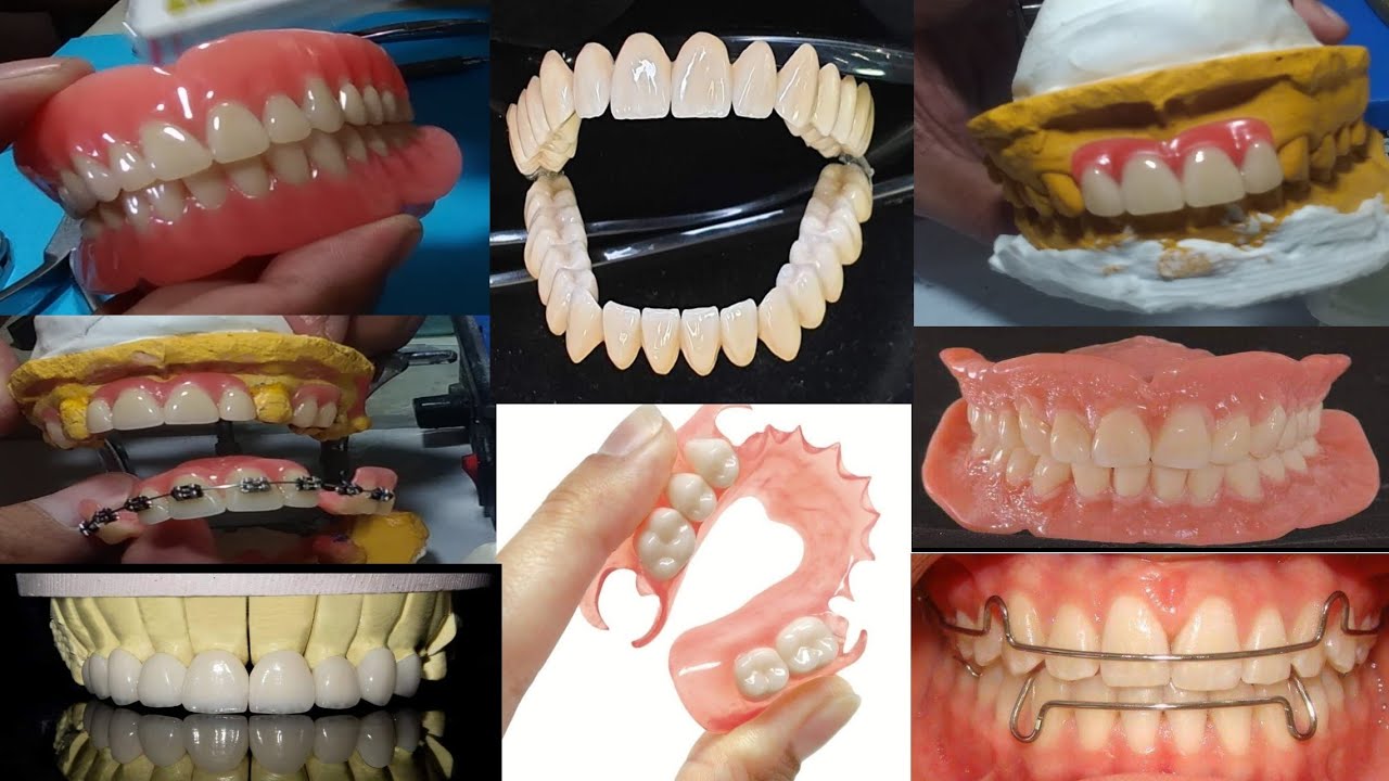 Dental Technician Work. Dental Technology Worldwide. Dentures, Retainers, PorcelainJacket Crown.