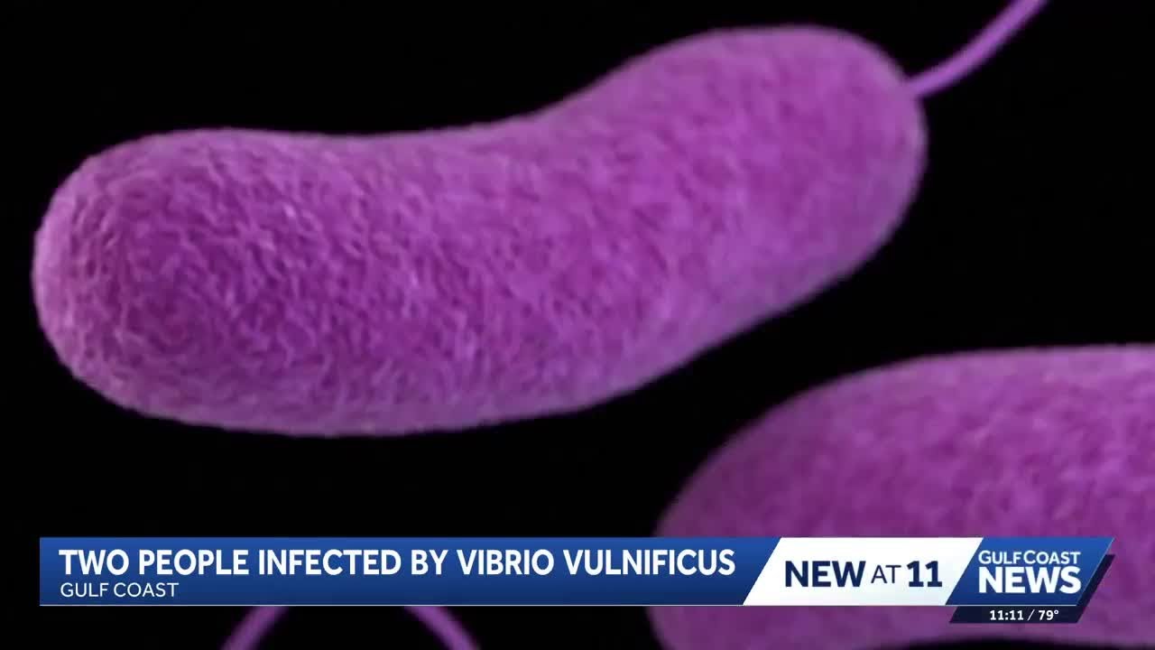 Florida Department of Health reports two new cases of Vibrio vulnificus