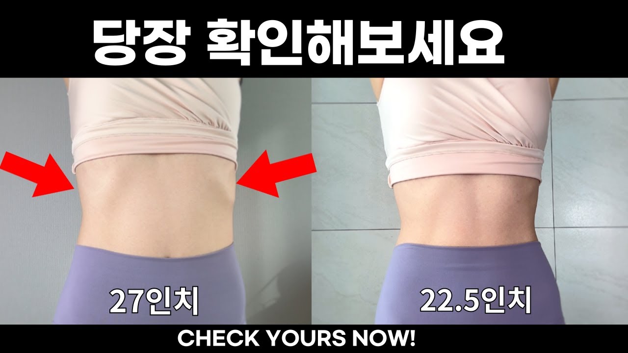 이걸 방치해서 몸통이 더 두꺼워지는거에요 (갈비뼈 튀어나옴 교정, 상체둘레 -5인치 줄이기)