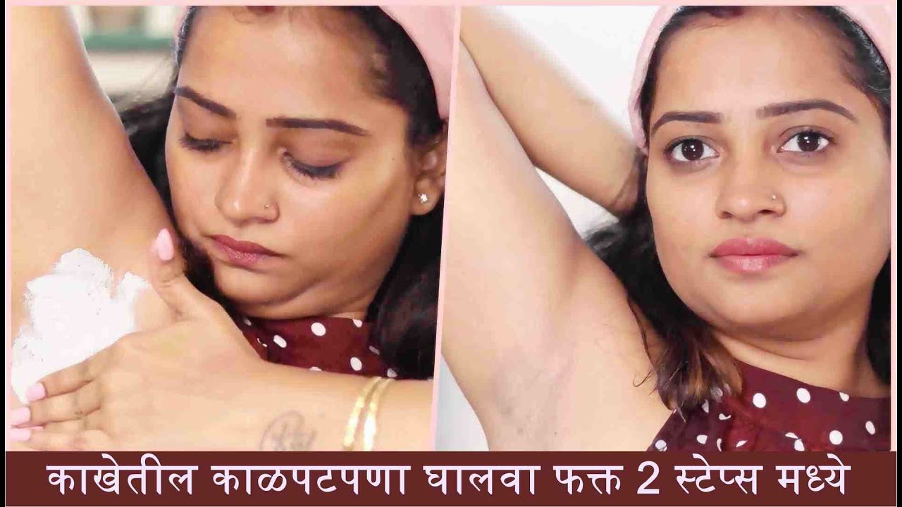 काखेतील काळपटपणा घालवा फक्त 2 स्टेप्स मध्ये - 2 Steps Underarm Whitening