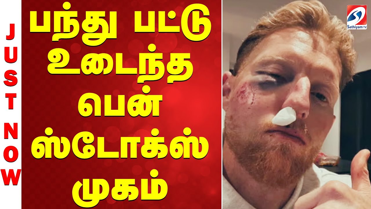 பந்து பட்டு உடைந்த பென் ஸ்டோக்ஸ் முகம்