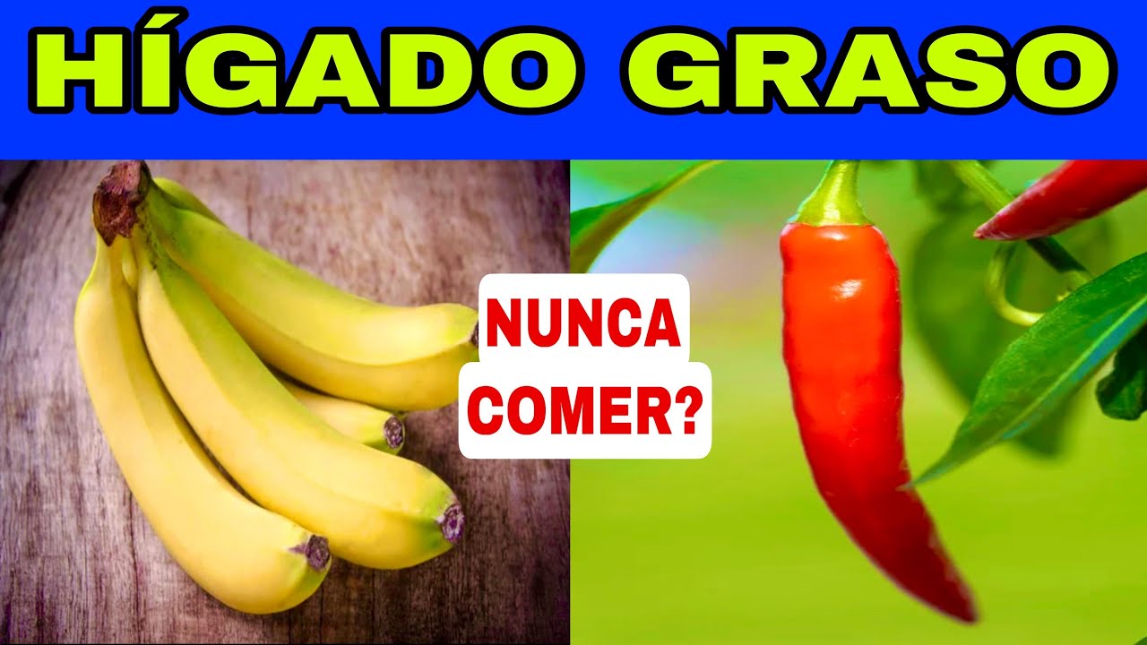 6 ALIMENTOS PROHIBIDOS para el HÍGADO GRASO y los 5 MEJORES para la ESTEATOSIS HEPÁTICA