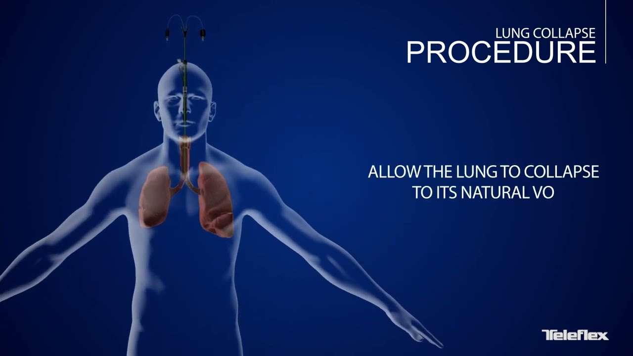 EZ Blocker Instructional Video_EN