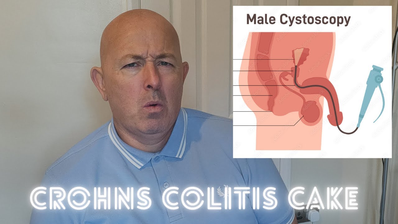 My Cystoscopy experience