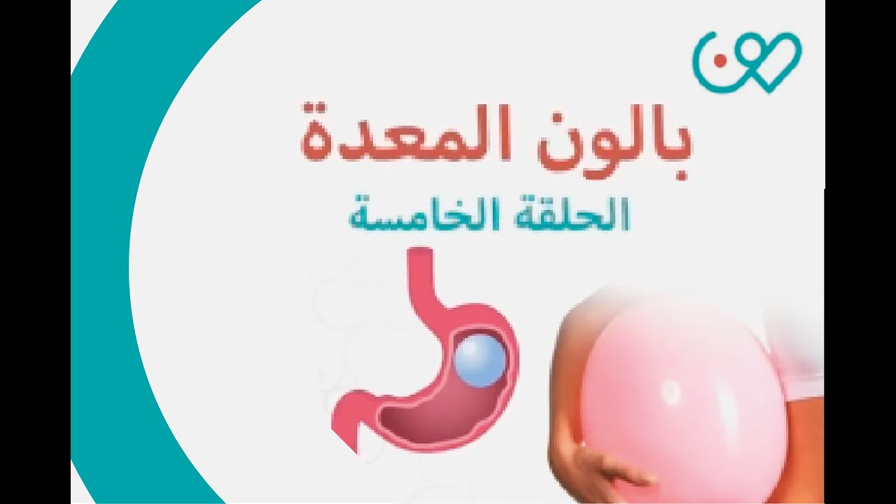 بودكاست برنامج من العيادة يقدمه البروفيسور عائض القحطاني - بالون المعدة🎈 الحلقة الخامسة