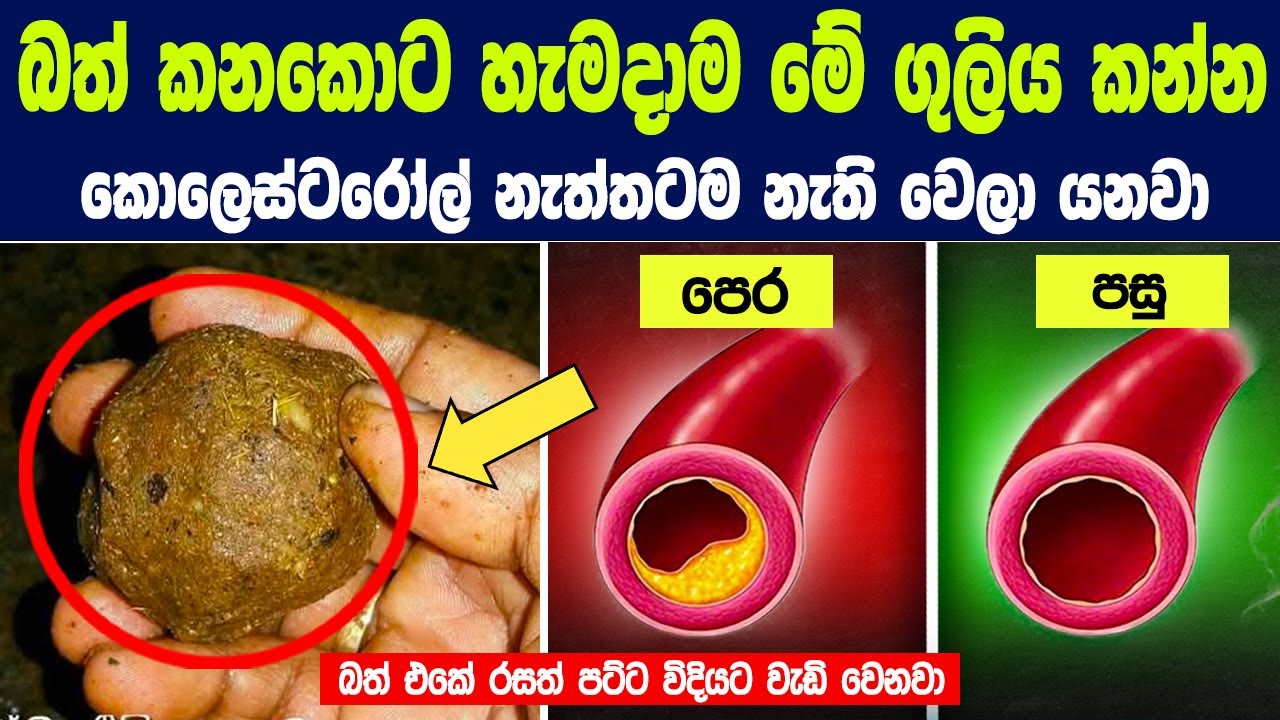බත් කනකොට හැමදාම මේ ගුලිය කන්න කොලෙස්ටරෝල් නැත්තටම නැති වෙලා යනවා