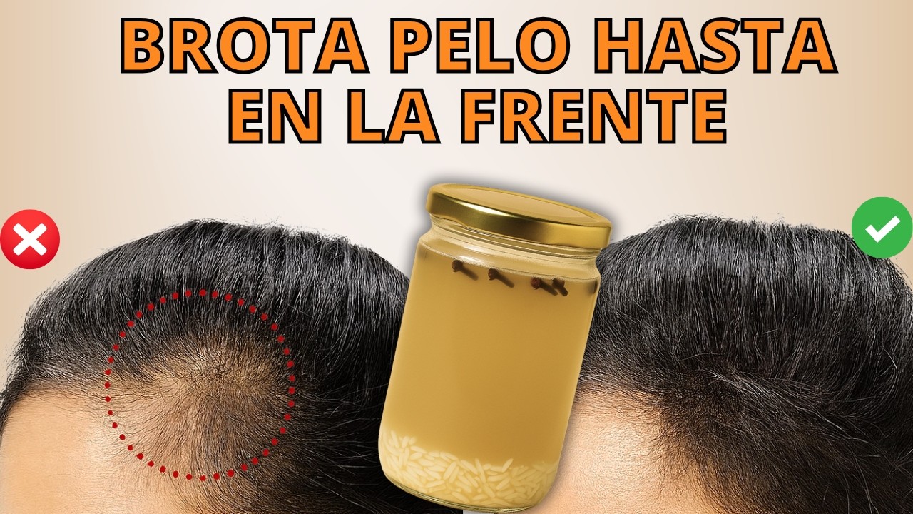 🟠CRECE TU CABELLO COMO LOCO EN DIAS Y NO SE CAE😱Con Ingredientes Naturales(Oro puro para tu Pelo)