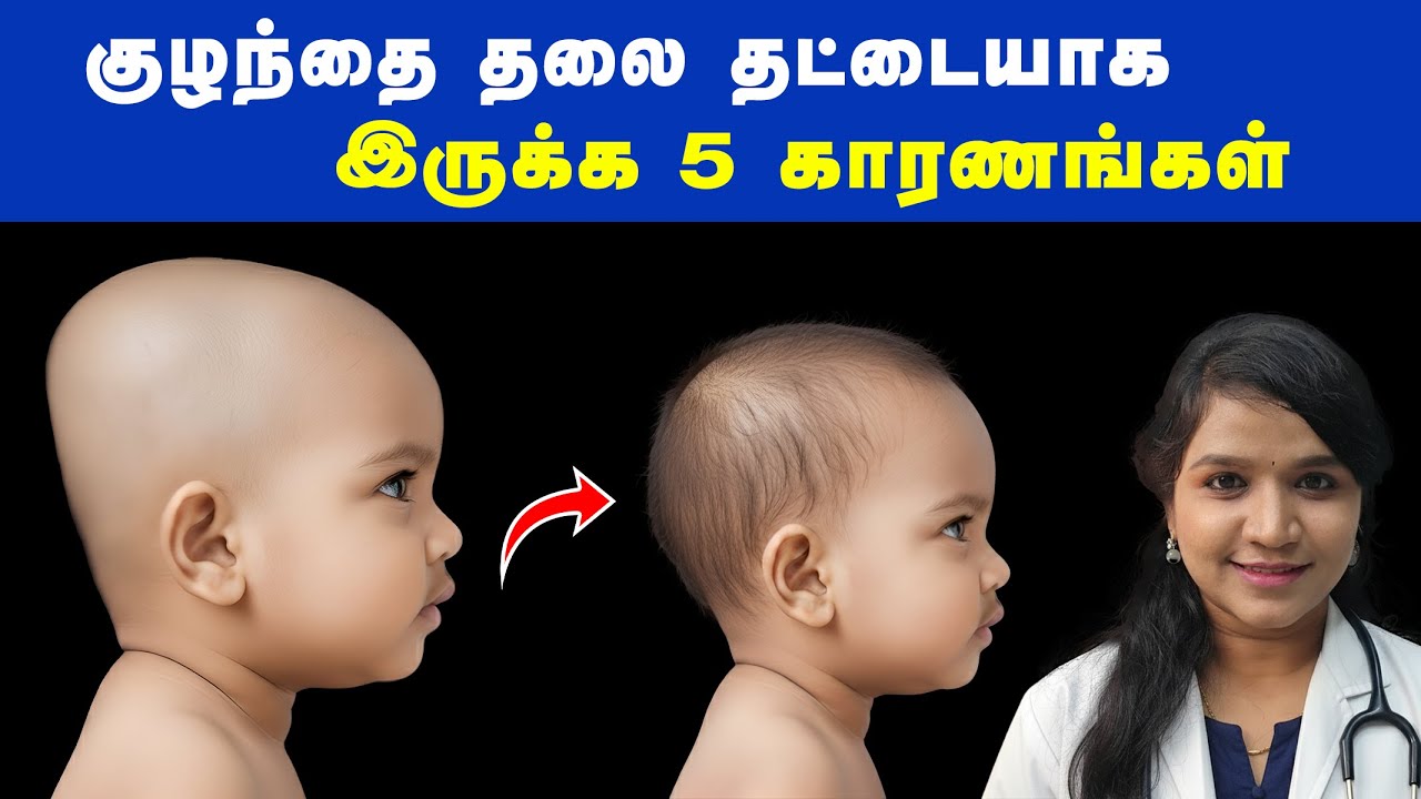 குழந்தை தலை தட்டையாக இருக்க 5 காரணங்கள் !Baby tips tamil