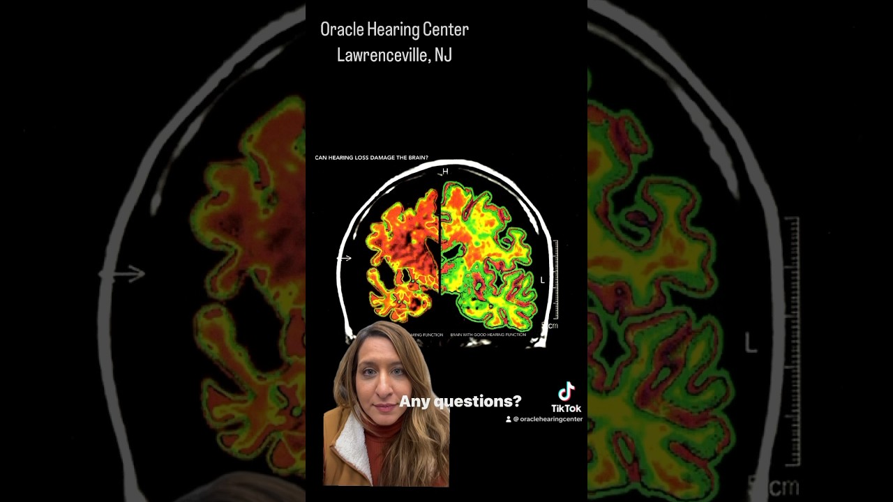 Hearing loss literally changes your brain