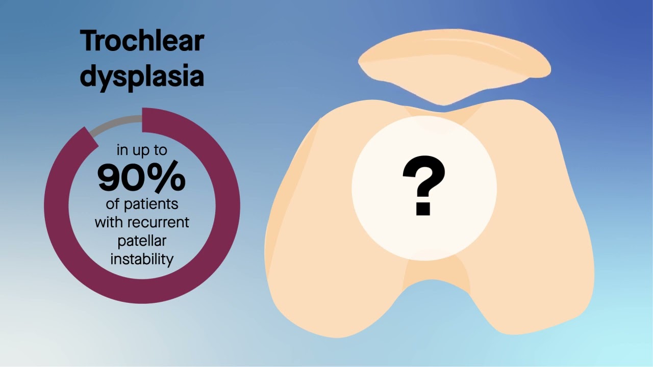 Unpacking the tibial tubercle&ndash;trochlear groove distance in patellar instability