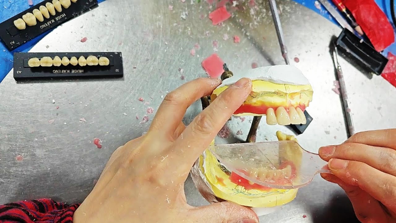 arrange the 28 teeth#custom denture processing#dentistry