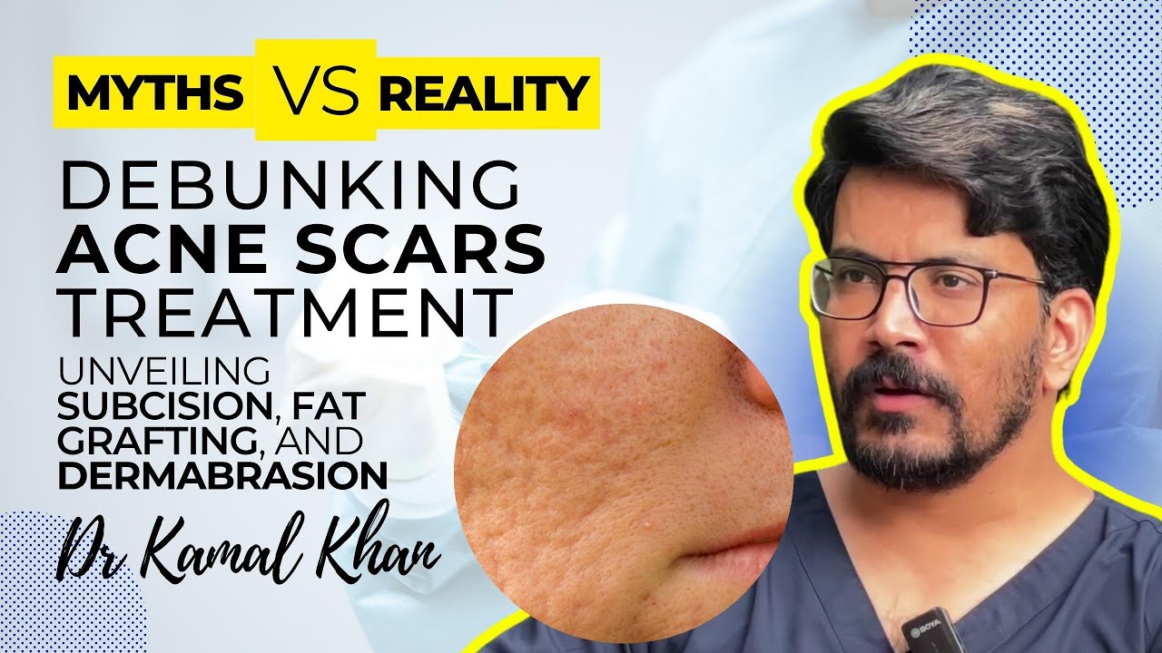 Dr. Kamal Debunking Acne Scar Treatment | Myths VS Reality | Cosmetico