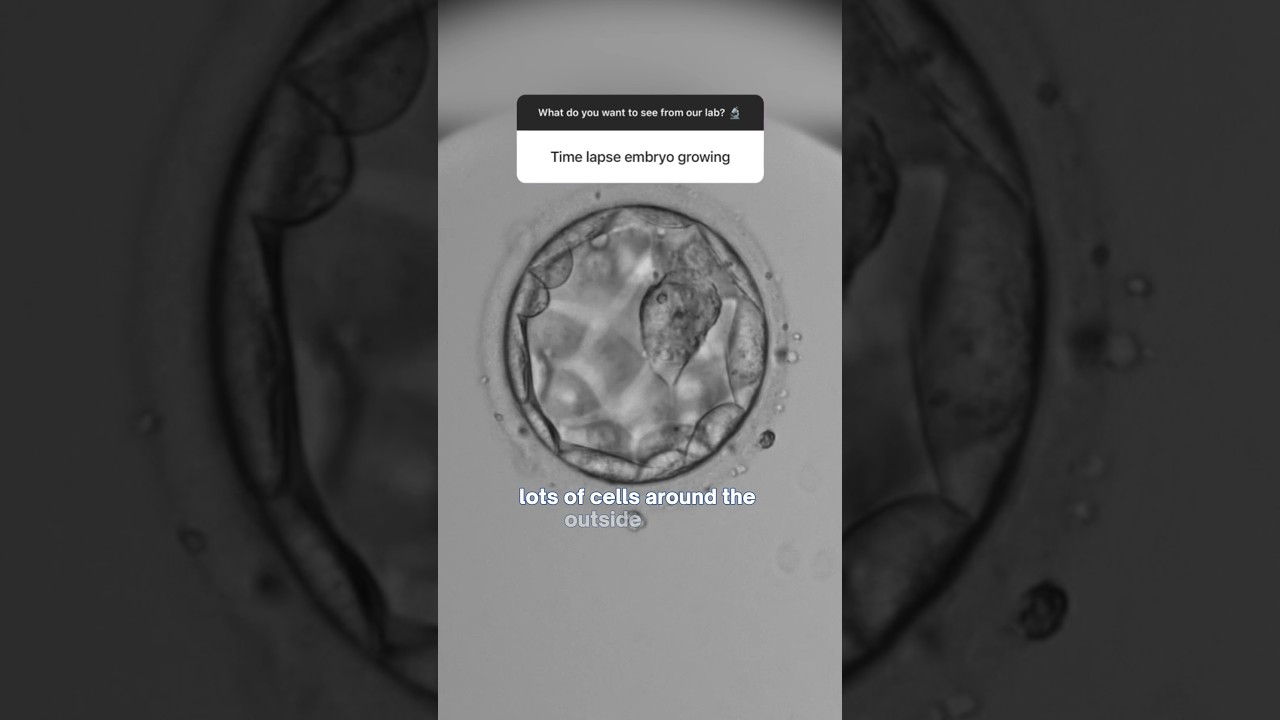 What are our embryologists looking for in our lab? 🧪 #ivf #embryology