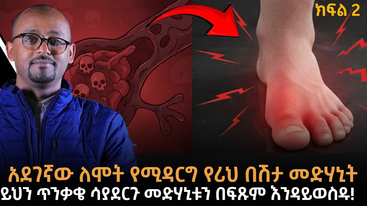 (ክፍል 2) ማስጠንቀቂያ! የሪህ በሽታ እና የደም መርጋት በድንገት የሚያመጡት አደጋ |መድሃኒት ሲጠቀሙ መዘንጋት የሌለብዎት 3 አደገኛ ስህተቶች! |ራፋቱኤል|