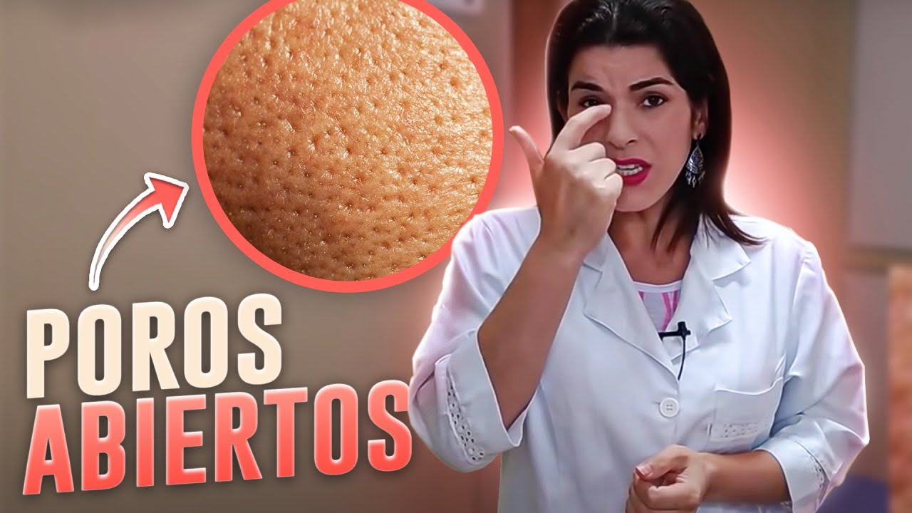 Cómo Cerrar los POROS DILATADOS - Causas de la dilatación de los poros y consejos para frenar