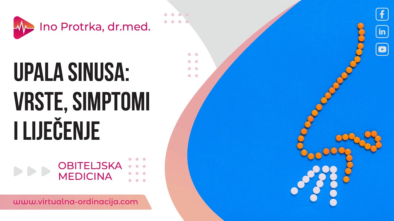 Upala sinusa: Vrste, simptomi i liječenje